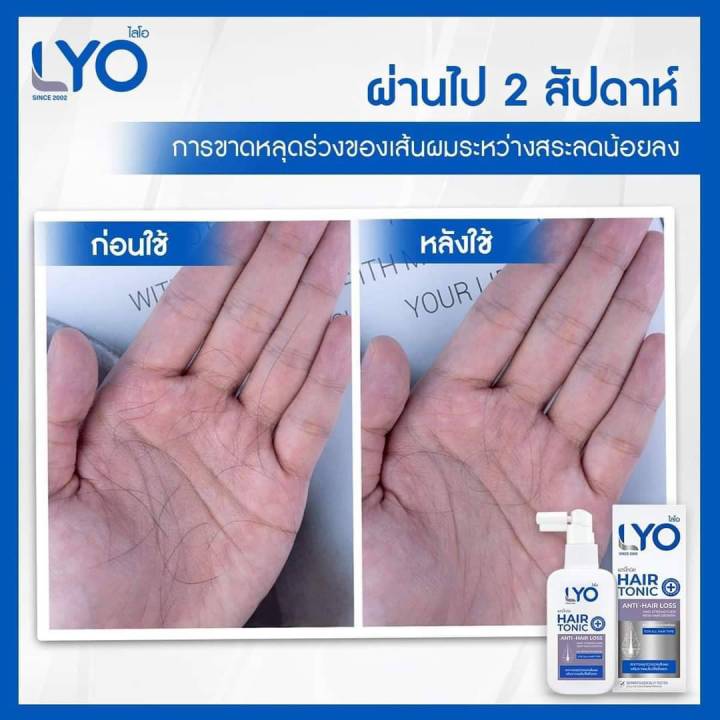 lyo-หนุ่มกรรชัย-ไลโอ-แฮร์โทนิค-แชมพู-ครีมนวด-lyo-hair-tonic-shampoo-conditioner-ผมเสีย-ร่วง-บาง-ล็อตใหม่-โปรโมชั่นล่าสุด