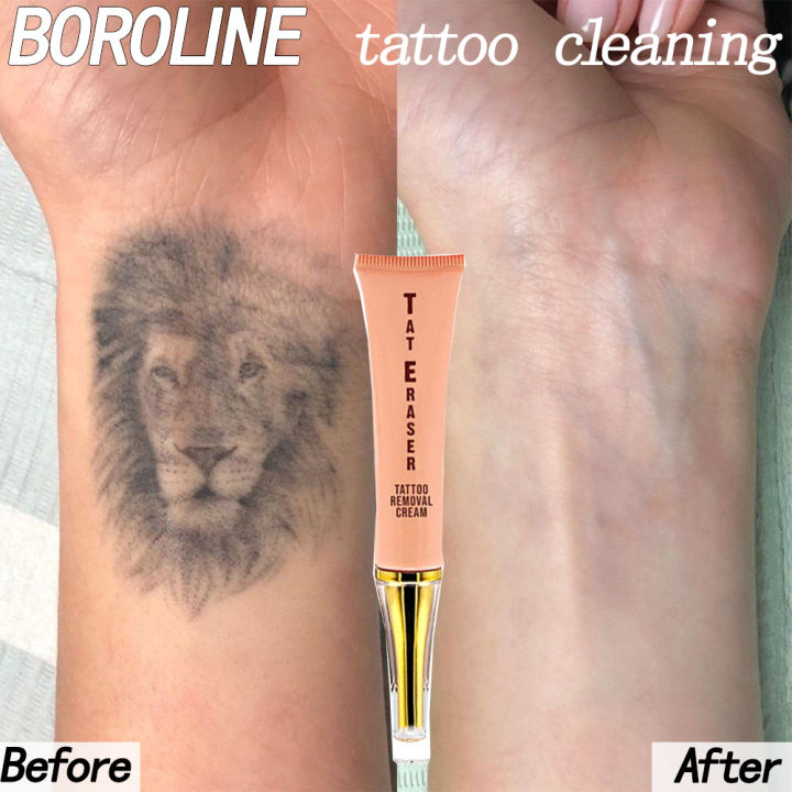 BAOIWEI Permanent Tattoo Removal Cream No Need for  Ubuy India