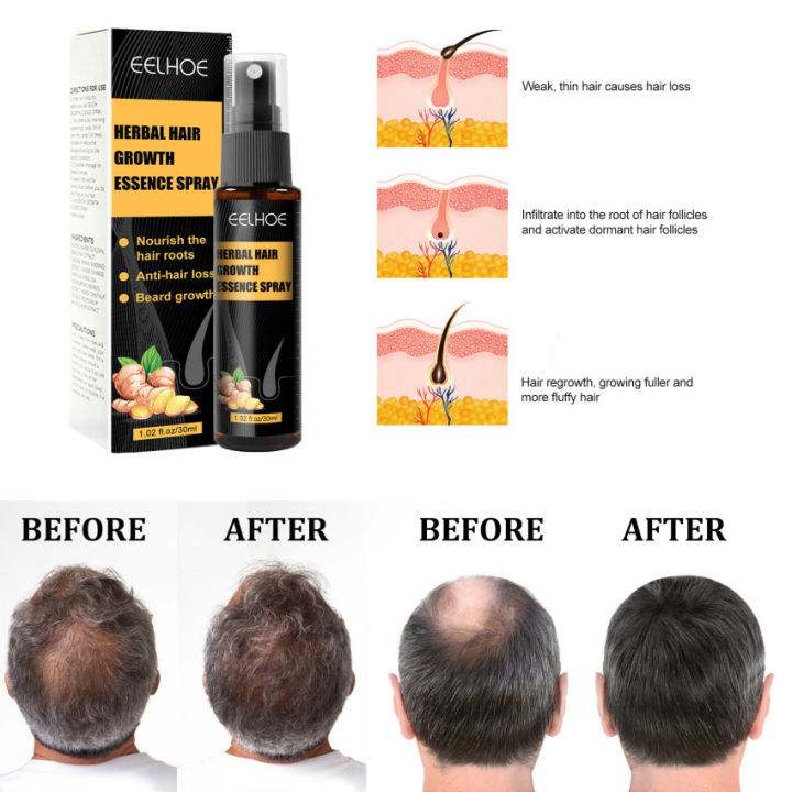 30ml-herbal-hair-growth-essence-spray-set-hair-loss-treatment-conditioner-nourishing-beard-hair-oil-spray