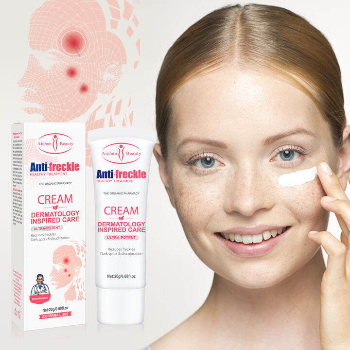 Powerful whitening freckle cream Nicotinamide face cream remove