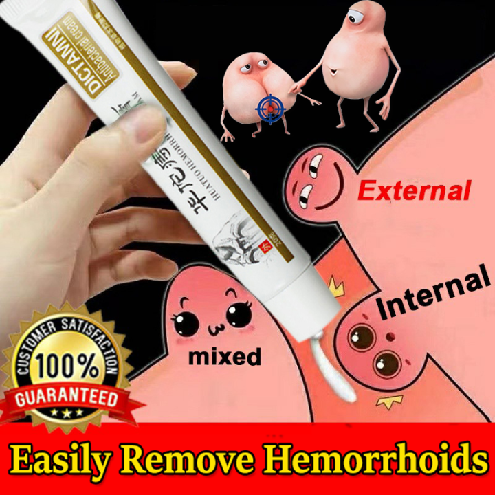 Safe And Effective Treatment Of Hemorrhoids Relieve Itchingburning Of Hemorrhoids Without 2010