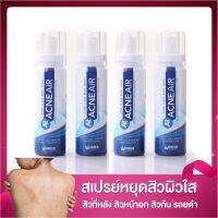 แพคสุดคุ้ม 4 กระป๋อง AcneAir  สเปรย์ฉีดสิวบนผิวกาย แอคเน่แอร์  สิวหลัง สิวหน้าอก รอยสิว รอยดำ สิวอักเสบ ล็อตใหม่