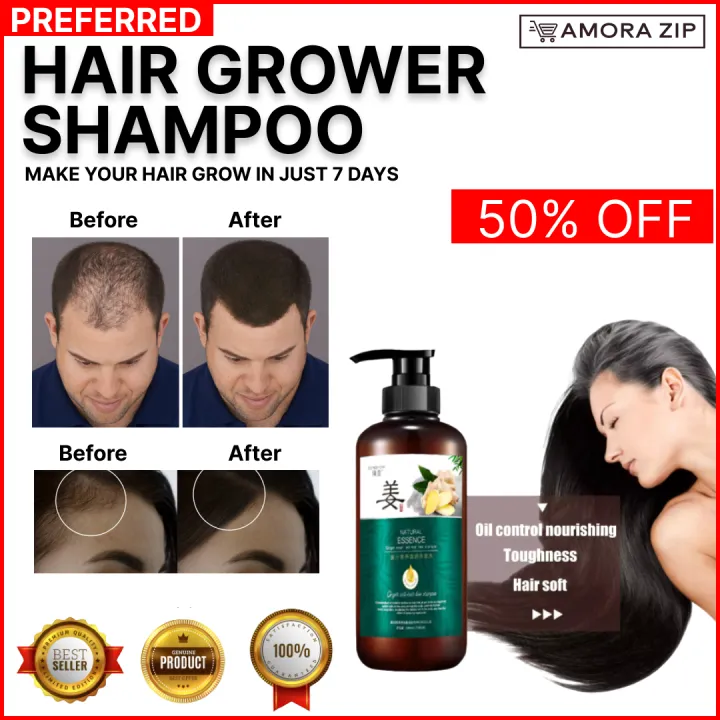 100% Original Hair growth shampoo Original Ginger Shampoo Prevent hair ...