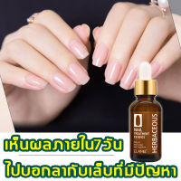 ELAIMEI น้ำมันบำรุงเล็บ 30 ml ป้องกันและกำจัดเชื้อราขึ้นที่เล็บ เล็บเปลี่ยนสีและเล็บหัก ช่วยให้เล็บกลับมาแข็งแรง ทำให้เล็บแข็งแรงมากขึ้น แก้ไขปัญหาเล็บหักง่าย เล็บบาง เล็บหนาเกิน ( เซรั่มบำรุงเล็บ ดูแลเล็บ เซรั่มรักษาเล็บ เอ็สเซ้นซ่อมแซมเล็บเสีย )