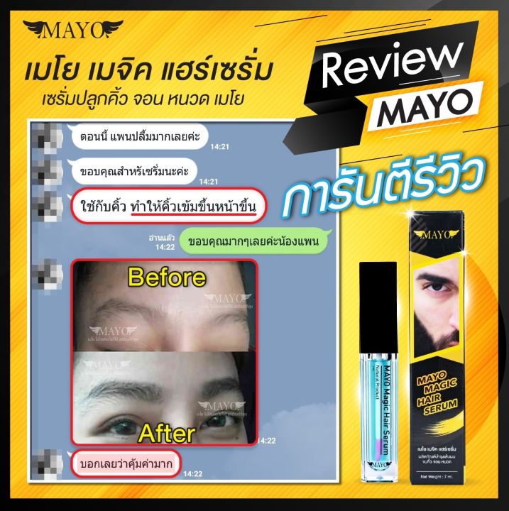 ส่งฟรี-เซรั่มปลูกคิ้วเมโย-คิ้วดก-คมเข้ม-เพิ่มความมั่นใจ-mayo-serum-7ml