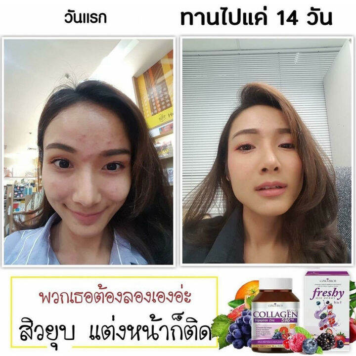 6-กระปุก-colla-rich-collagen-คอลลาริช-คอลลาเจน-ขนาด-60-แคปซูล