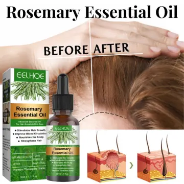 Pure Rosemary Oil Hair - Best Price in Singapore - Jan 2024
