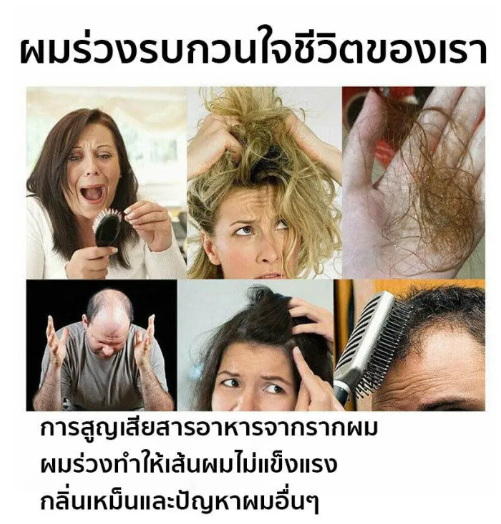 ซ่อมแซมรูขุมขน-สระออกผมหนาแน่น-peimei-แชมพูลดผมร่วง-ป้องกันผมล่วง-บำรุงรากผม-ปรับหยาบกร้าน-การดูแลหนังศีรษะ-เสริมสร้างเส้นผม-แชมพูแก้ผมร่วง-ยาสระผมเร่งยาว-แชมพูเร่งผมยาว-สระผมขิง-เซรั่มเร่งผมยาว-เซรั่