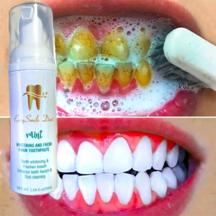 EasySmile Dent Whitening Foam Toothpaste Removes TarTar and Bad