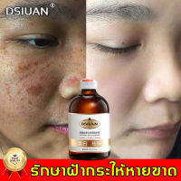 DSIUANครีมทาฝ้าลึกไวท์เทนนิ่ง100ml  จุดด่างดำ ให้ความชุ่มชื่นชั้นสูง ยกระดับผิวขาวใส（ครีมถาหน้าขาว เชรั่มทาฝ้า ครีมรักษาฝ้า ครีมแก้ฝ้าลึก เซรั่มทาฝ้า ครีมทาฝ้า ครีมทาฝ้าหนาๆ ไวท์เทนนิ่งเอสเซ้นส์ ครีม แก้ ฝ้า กระ การทำให้สว่าง ครีมลอกฝ้า ครีมลดฝ้