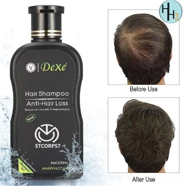 Hair Growth Stimulating Shampoo Anti-Hair Loss Hair Shampoo Thinning Hair  Treatment - For men & women 200ML | Lazada PH