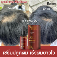 [โปรสุดคุ้มส่งฟรี] HAEWON เซรั่มปลูกผม แฮวอน 30ml ผลิตภัณฑ์ดูแลผม บำรุงผม เร่งผมยาว หนาขึ้น ลูกผมดก หมดปัญหาผมบาง ผมร่วง หัวล้าน Hair care