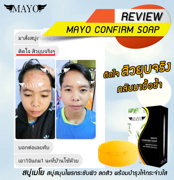 สบู่เมโย-หน้าใส-กระชับผิว-ลดสิว-พร้อมบำรุงให้ขาวใส-mayo-soap-สารสกัดจากธรรมชาติมากกว่า-10-ชนิด