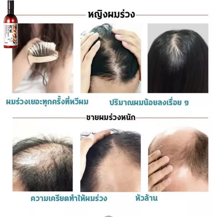 ของแท้-พร้อมส่ง-รากผมเป็นสีดํา-แชมพูปิดผมหงอก-แชมพูแก้ผมหงอก-แชมพูเหอโส่วอู-250ml-my-organic-แก้ผม-หงอก-แก้ผมหงอกถาวร-แชมพูปิดหงอก-ผมหงอกกลับมาดำ-แชมพูสมุนไพร-น้ำยาแก้ผมหงอก-แชมพูผมดกดำ-เซรั่มลดผมหงอก