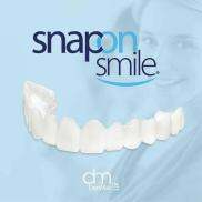 EuroHome Răng thẩm mỹ Snap on smile