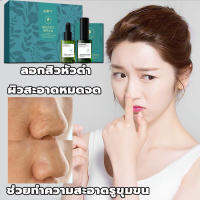 AOPY สูตรอ่อนโยน กำจัดสิวหัวดำ 3 in 1 Set ลบสิวหัวดำและสิว บำรุงกระชับรูขุมขน ขจัดผิวที่ตายแล้ว ผิวกระจ่างใส ครีมลอกสิวเสี้ยน ลอกสิวหัวดำ สิวอุดตัน ลอกได้ทั้งหน้า สูตรใหม่ สำหรับคนเป็นสิว และผิวแพ้ง่าย ( ที่ลอกสิวเสี้ยน ลอกสิวเสี้ยน มาร์คหน้าสิวเสี้ยน)