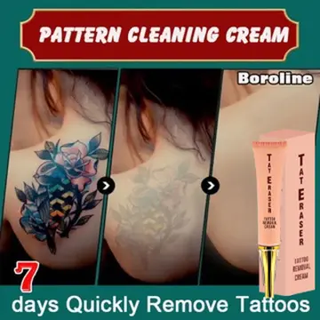 PicoWay - Painless Tattoo Removal in Utah