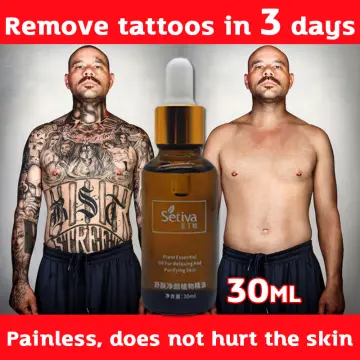 Permanent Tattoo Removal Cream No Need For Pain Removal Maximum Strength |  eBay