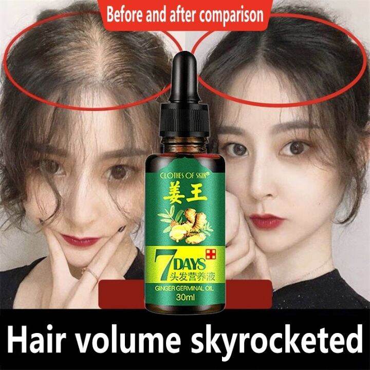 Ginger Hair Growth Serum Anti Hair Loss Fast Hair Growing Spray Treatment Dry Frizzy Sparse 5294