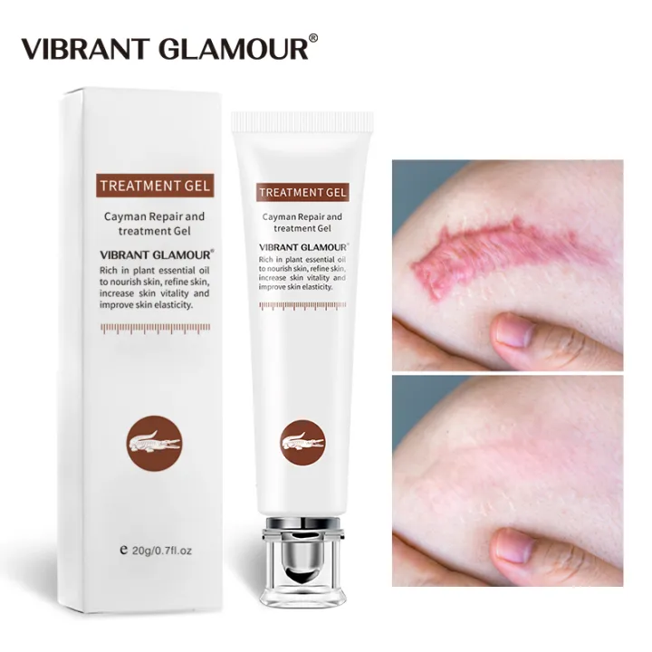 VIBRANT GLAMOUR Repair Scar Cream Removal Scars For Face Or Body Pigmentation Corrector Scalded