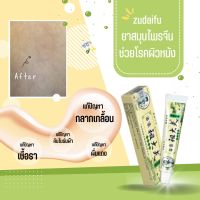 （พร้อมส่ง）ของแท้100%ZudaifuSoapสบู่สมุนไพรจีน สบู่ก้อน สบู่กำมะถัน สีชมพู สบู่ต้านเชื้อราไวท์เทนนิ่งธรรมชาติ การดูแลผิว 80g/20g