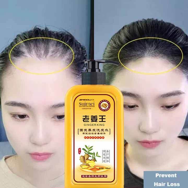 Original Ginger Shampoo Fast Powerful Hair Growth Liquid Anti Hair Loss Shampoo 500ml Lazada Ph 9973