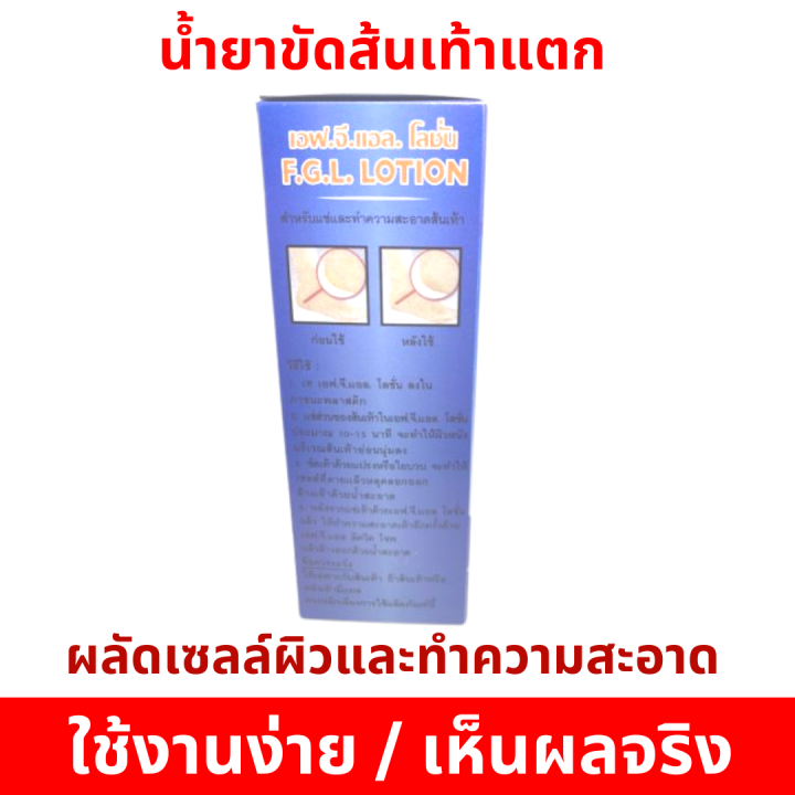 สุดคุ้ม-ชุดเซ็ต-5-ขวด-ใช้ได้นาน-น้ำยาขัดส้นเท้าแตก-ช่วยทำความสะอาด-ขจัดเซลล์ผิวเก่าให้หลุดลอกออก-ใช้งานง่าย-สะดวก