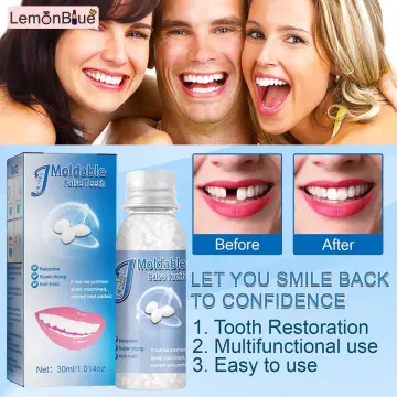 3 Colors Tooth Solid Gel Temporary Repair Kit Moldable Thermal