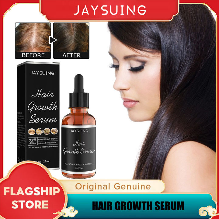 Jaysuing Ginger Hair Growth Serum Ginseng Prevent Hair Loss Essential ...