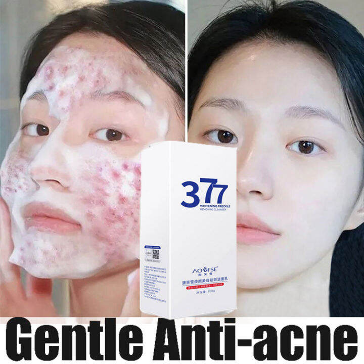 377 Facial Cleanser Face Wash Remove Acne Blackhead Removal Oil Control