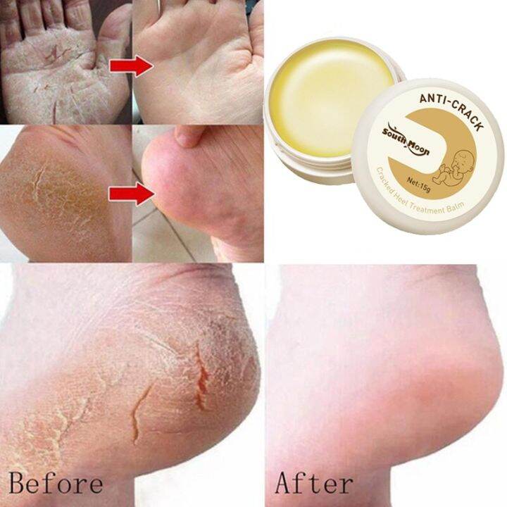 cw-herbal-anti-drying-crack-foot-cream-heel-cracked-repair-removal-dead-skin-moisturizing-nourishing-hand-feet-care-mask-15g