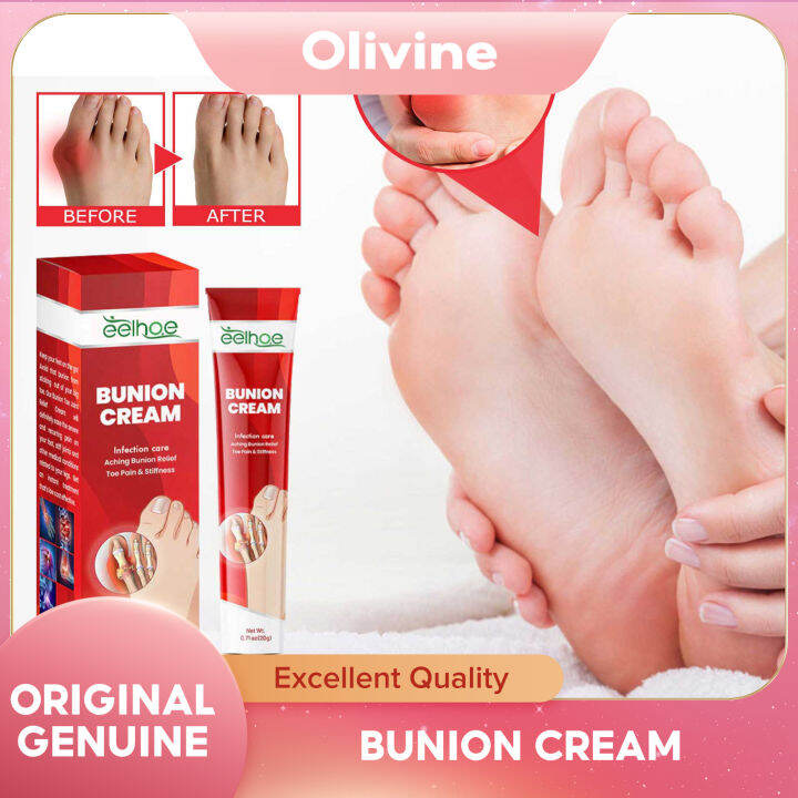 Eelhoe Thumb Bladder Cream Alleviates Swelling Of The Thumb And Sole Of ...