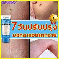 แท้ 100%GUANJINGครีมทาท้องลาย ครีมทาท้องลาย80g  แก้ท้องลาย ลดรอยแตกลาย สะโพกลาย ผิวลาย ขาแตกลาย ครีมทาขาแตก