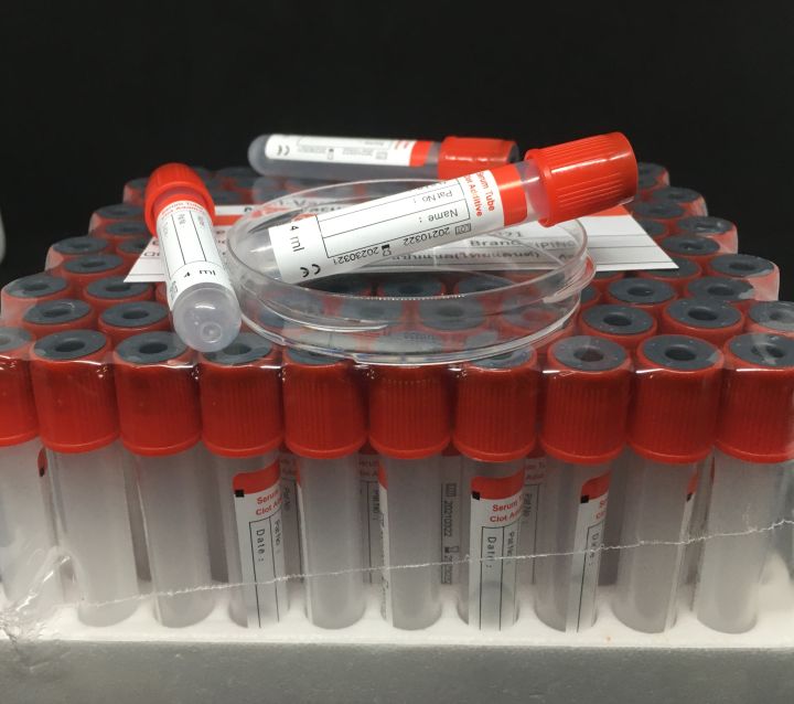 หลอดเก็บเลือด-clot-activator-non-vac-tube-จุกสีแดง-หลอดบรรจุสิ่งส่งตรวจ-ขนาด-4-ml-size-13-75-mm-100-ชิ้น-แพ็ค