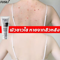 【ลดราคาครั้งใหญ่】FUSILI ครีมทาผิวขาว×1000 ครีมทาผิวขาว โลชั่นผิวขาว 200g สูตรไวท์เทนนิ่ง ซึมเร็ว ปรับปรุงผิวแห้ง（ ครีมทาผิวขาวไว โลชั่น บำรุงผิวขาว ครีมทาผิว โลชั่นทาตัว ครีมบำรุงผิ โลชั่นทาผิว ครีมทาตัว บอดี้โลชั่น)