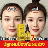 ?จัดส่งในวันเดียวกัน?ผมงอกขึ้นใหม่ใน 7 วัน เซรั่มบำรุงผม 40ml ยาปลูกผมของแท้ เร่งเส้นผมและบอกลาหนังศีรษะล้าน （ เซรั่มบำรุงผม ยาปลูกผมของแท้ น้ำยาปลูกผมแท้ เซรั่มปลูกผม นำ้ายาปลูกผม น้ำยาเร่งผมยาว ยากินปลูกผม ยาทาปลูกผม เชรำ่บำรุงผม）