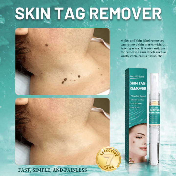 warts remover original warts removal warts remover original watson skin