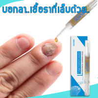 ของแท้100% ยาเชื้อราเล็บ nail fungus เซรั่มซ่อมแซมเล็บ ซ่อมแซมเล็บเสีย กำจัดเล็บเสีย ส่งเสริมการเจริญเติบโตของเล็บดีเยี่ยม ยากันเชื่อราเล็บ（ครีมบำรุงเล็บ ยาแก้เชื้อราที่เล็บ น้ำยาต้านเชื้อรา เซรั่มเล็บขบ ยาใส่เล็บเป็นเชื้อรา น้ำยาบำรุงเล็บ เชื้อราเล็บมือ）