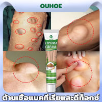 แท้OUHOE ออกแบบ36ชนิดของไขมันใต้ผิวหนังกำจัดมวลก้อนไปยังถุงน้ำ Lymph Care Ointment สมุนไพรกำจัด ก้อนเนื้อใต้ผิวหนัง ก้อนซีสต์ ก้อนไขมัน ครีมทาซีส ก้อนไขมัน ครีมระบายน้ำเหลือง ครีมน้ำเหลืองแบบอ่อนโยน ครีมบวมคอ ต่อมน้ำเหลืองบริเวณรักแร้ พร้อมส่งทั่ว