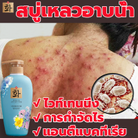 【 ป้องกันผิวแห้ง บรรเทาอาการคันผิวหนัง ลดไรและสิวตามร่างกาย】ครีมอาบนำ้ลดสิว 500ML อ่อนโยนไม่ระคายเคือง เจลอาบน้ำ ครีมอาบน้ำขาว ครีมอาบน้ำเด็ก  ครีมอาบน้ำหอมๆ ครีมอาบน้ำผิวขาว สบู่เหลวอาบน้ำ  ครีมอาบน้ำทีทรี ครีมอาบน้ำสิว สบู่อาบน้ำ ครีมอาบน้ำ shower gel