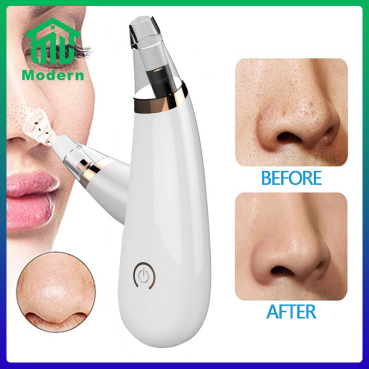 Modern เครื่องดูดสิว สิวข้างจมูก ดูดสิวเสี้ยนอุดตันลบรอยจุดดำจากสิวเสี้ยนที่จมูก  สิวหัวดำ ที่ดูดสิวเสี้ยน ได้ 3 ระดับ กำจัดสิว | Lazada.Co.Th