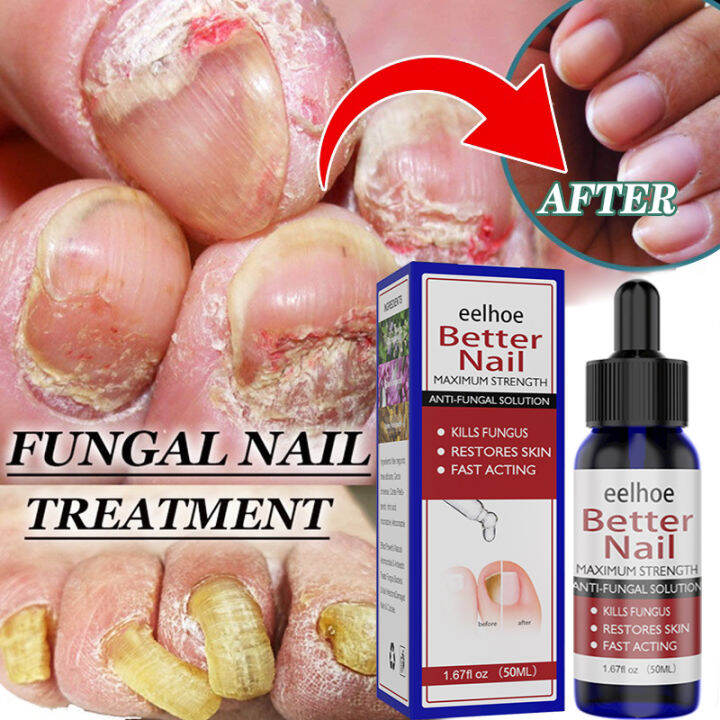 Nail repair liquid 50ml Fungal Nail Repair Essence Quickly repair
