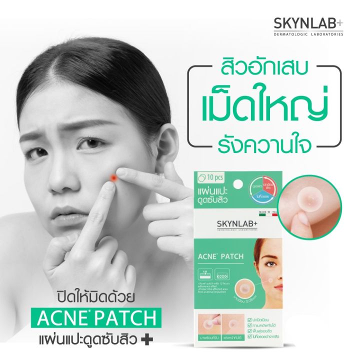 skynlab-acne-patch-แผ่นแปะสิว-ดูดซับสิว-ลดการเกิดสิวและสิวอักเสบ-แต่งหน้าทับได้เนียนสนิท