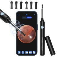 Ear Wax Removal Kit Ear Camera 1296P Ear Cleaner Ear Wax Remover 3.5mm Waterproof Ear Endoscope Camera Earwax Remover Tool fo