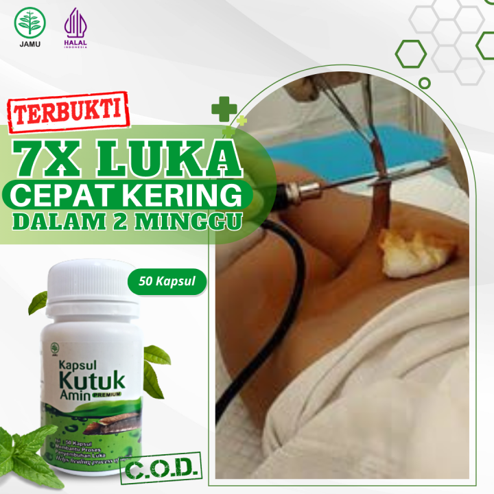 Kapsul Kutuk Amin Obat Luka Luar Agar Cepat Kering Penghilang Luka Pengering Luka Bernanah 