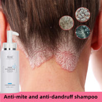 Make a friend Amino acid shampoo psoriasis shampoo scalp psoriasis Lasting Fragrance sea salt shampoo Dry Hairy Smooth Hair Amino acid anti-dandruff shampoo it psoriasis shampoo, anti-dandruff shampoo mite removal shampoo, hair care shampoo