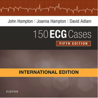 150 ECG Cases, 5 ed (IE version) - ISBN : 9780702074592 - Meditext