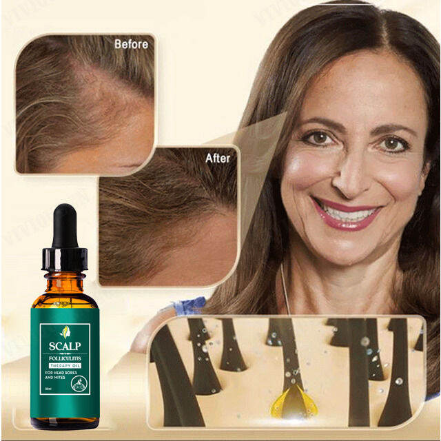 biaozhen Conditioning Hair Treatment Oil Hair Root Dense Hair Repair