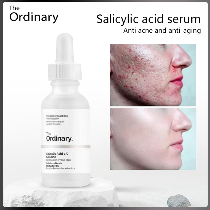 The Ordinary Salicylic Acid 2 Solution salicylic acid serum shrinks