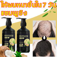 300ML แชมพูขิง แชมพูขิงของแท้ แชมพูปลูกผมดก แชมพูป้องกันผมร่วง สมุนไพรธรรมชาติล้วนๆ ป้องกันผมร่วง+บำรุงผม แชมพูผมร่วง สำหรับผมบาง